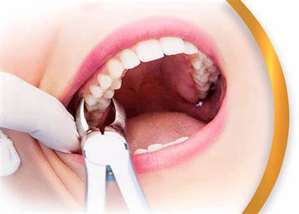 دندان اضافه پشت دندان شیری در کودکان