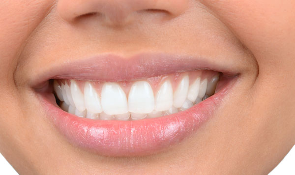شرایط لازم برای کامپوزیت کردن یک دندان