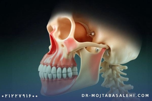 رشد عرضی استخوان صورت