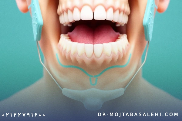 هزینه جراحی فک