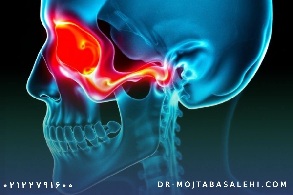 انواع شکستگی فک