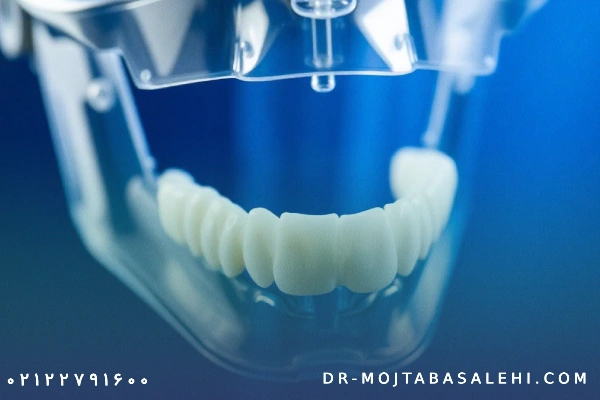 قیمت پروتز فک پایین