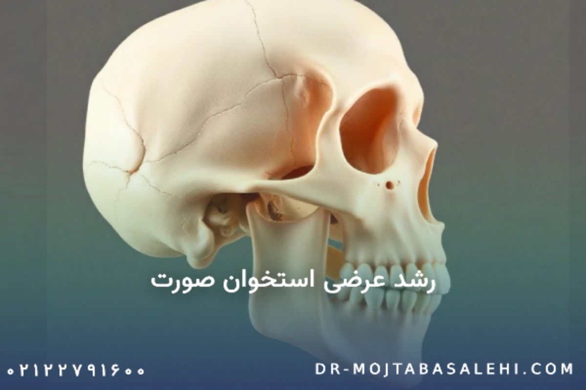 رشد عرضی استخوان صورت