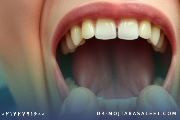 تمرینات برای باز کردن فک