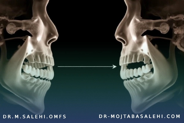 جراحی ارتوگناتیک فک