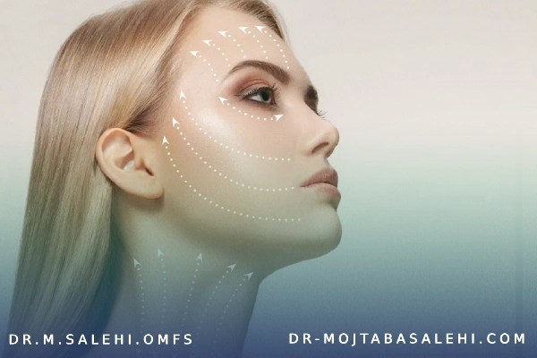 هزینه زاویه سازی صورت دائمی